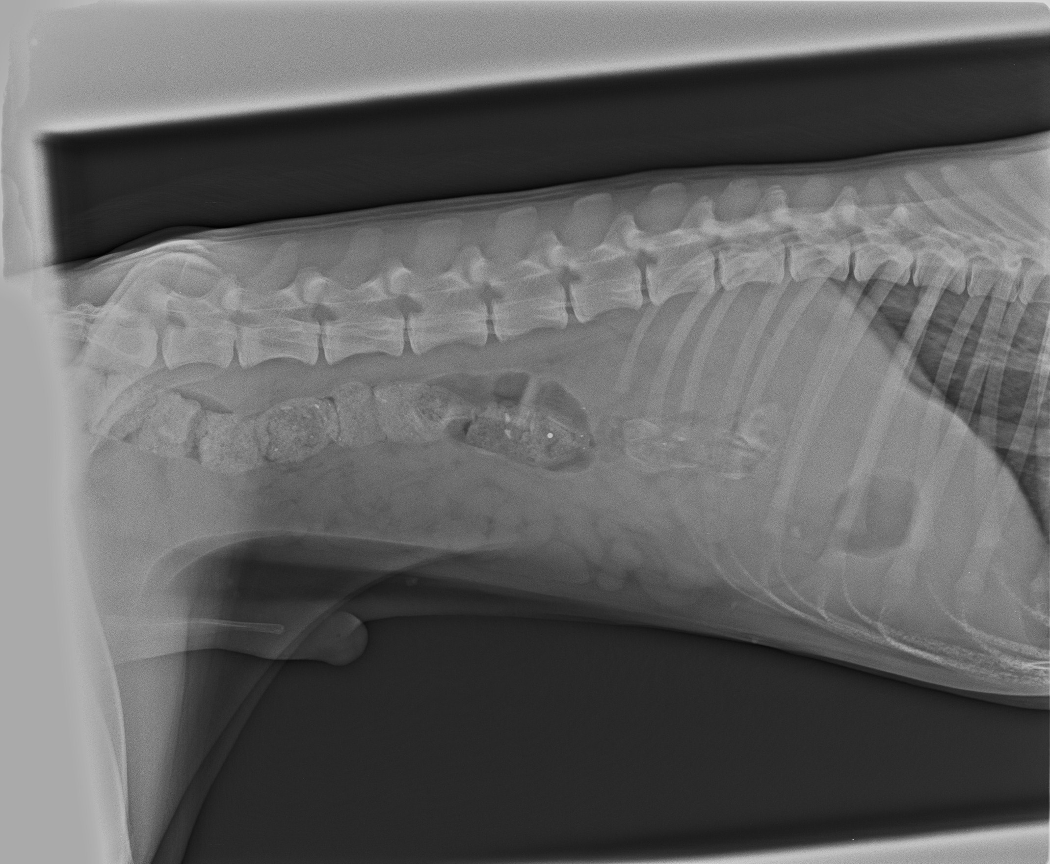 צילום רנטגן שליטרלי של חלל הבטן של ג'יי ג'יי xray